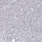 Immunohistochemical staining of human liver shows no positivity in hepatocytes as expected.