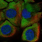 Immunofluorescent staining of human cell line HaCaT shows localization to cytosol.
