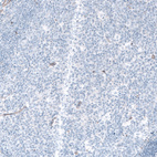 Immunohistochemical staining of human tonsil shows no positivity in germinal center cells as expected.