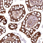 Immunohistochemical staining of human small intestine shows strong membranous-cytoplasmic positivity in glandular cells.