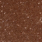 Immunohistochemical staining of human cerebral cortex shows strong cytoplasmic positivity in neuropil and membranous positivity in glial cells.