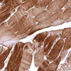 Immunohistochemical staining of human skeletal muscle shows strong cytoplasmic positivity in myocytes.