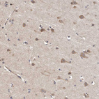 Immunohistochemical staining of human cerebral cortex shows moderate cytoplasmic positivity in neurons.