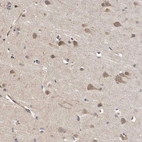 Immunohistochemical staining of human cerebral cortex shows moderate cytoplasmic positivity in neurons.