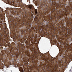 Immunohistochemical staining of human pancreas shows strong cytoplasmic positivity in exocrine glandular cells.