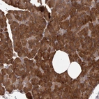 Immunohistochemical staining of human pancreas shows strong cytoplasmic positivity in exocrine glandular cells.
