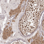Immunohistochemical staining of human testis shows strong nuclear positivity in cells in seminiferous ducts in addition to cytoplasmic positivity and also cytoplasmic positivity Leydig cells.