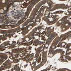 Immunohistochemical staining of human duodenum shows strong cytoplasmic-membranous positivity in glandular cells.