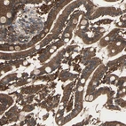 Immunohistochemical staining of human duodenum shows strong cytoplasmic-membranous positivity in glandular cells.