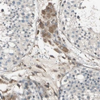 Immunohistochemical staining of human testis shows moderate cytoplasmic positivity in Leydig cells.
