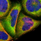 Immunofluorescent staining of human cell line A-431 shows localization to cytosol.