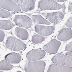 Immunohistochemical staining of human skeletal muscle shows no positivity in myocytes.