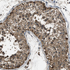 Immunohistochemical staining of human testis shows moderate nuclear-cytoplasmic positivity in cells in seminiferous ducts.