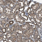 Immunohistochemical staining of human kidney shows moderate nuclear-cytoplasmic positivity in cells in tubules.