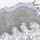 Immunohistochemical staining of human skin shows no positivity in squamous epithelial cells.