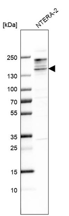 Western blot analysis in human cell line NTERA-2.