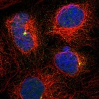 Immunofluorescent staining of human cell line A-431 shows localization to centrosome.