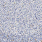 Immunohistochemical staining of human tonsil shows no membranous positivity in germinal center cells as expected.