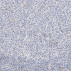 Immunohistochemical staining of human tonsil shows no membranous positivity in germinal center cells as expected.
