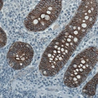 Immunohistochemical staining of human colon shows strong membranous immunoreactivity in glandular cells.
