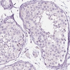 Immunohistochemical staining of human testis shows no positivity in cells in seminiferous ducts as expected.