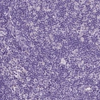 Immunohistochemical staining of human lymph node shows no positivity in non-germinal center cells as expected.