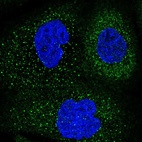 Anti-MINDY4 Antibody