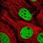 Immunofluorescent staining of human cell line CACO-2 shows localization to nucleoplasm.
