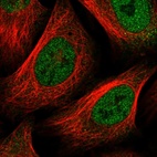 Anti-FOXC1 Antibody