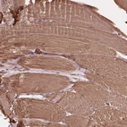 Immunohistochemical staining of human skeletal muscle shows moderate cytoplasmic positivity in myocytes.