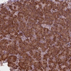Immunohistochemical staining of human pancreas shows moderate cytoplasmic positivity in exocrine glandular cells.