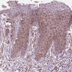Immunohistochemical staining of human skin shows weak cytoplasmic positivity in squamous epithelial cells.