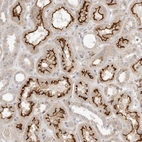 Immunohistochemical staining of human kidney shows strong membranous positivity in cells in tubules.