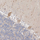 Immunohistochemical staining of human cerebellum shows moderate cytoplasmic positivity in Purkinje cells.