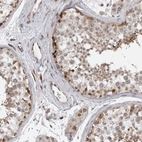 Immunohistochemical staining of human testis shows moderate cytoplasmic and nucleus positivity in cells in seminiferous ducts.