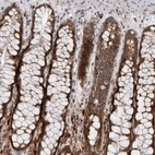 Immunohistochemical staining of human rectum shows moderate cytoplasmic and nucleus positivity in glandular cells and Leydig cells.