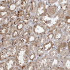 Immunohistochemical staining of human kidney shows moderate cytoplasmic and nucleus positivity in cells in tubules.