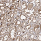 Immunohistochemical staining of human kidney shows moderate cytoplasmic and nucleus positivity in cells in tubules.