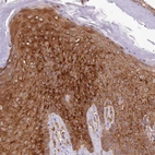 Immunohistochemical staining of human skin shows strong cytoplasmic positivity in squamous epithelial cells.