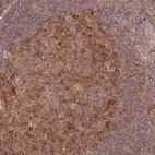 Immunohistochemical staining of human tonsil shows moderate cytoplasmic positivity in germinal center cells.