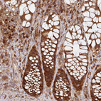 Immunohistochemical staining of human rectum shows strong cytoplasmic positivity in glandular cells.