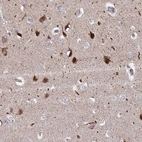 Immunohistochemical staining of human cerebral cortex shows strong cytoplasmic positivity in neuronal cells.