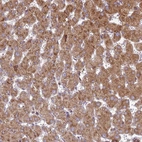 Immunohistochemical staining of human liver shows moderate cytoplasmic positivity in hepatocytes.