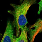 Immunofluorescent staining of human cell line U-2 OS shows localization to plasma membrane & cytosol.