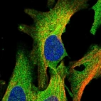 Immunofluorescent staining of human cell line U-2 OS shows localization to plasma membrane & cytosol.