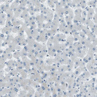 Immunohistochemical staining of human liver shows no positivity in hepatocytes as expected.