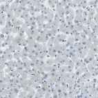 Immunohistochemical staining of human liver shows no positivity in hepatocytes as expected.