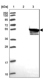 Lane 1: Marker [kDa] 250, 130, 95, 72, 55, 36, 28, 17, 10_br/_Lane 2: Human cell line RT-4_br/_Lane 3: Human cell line U-251MG sp