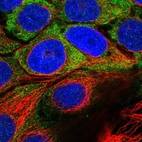 Immunofluorescent staining of human cell line CACO-2 shows localization to cytosol.