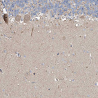 Immunohistochemical staining of human cerebellum shows moderate cytoplasmic-nucleoli positivity in Purkinje cells.